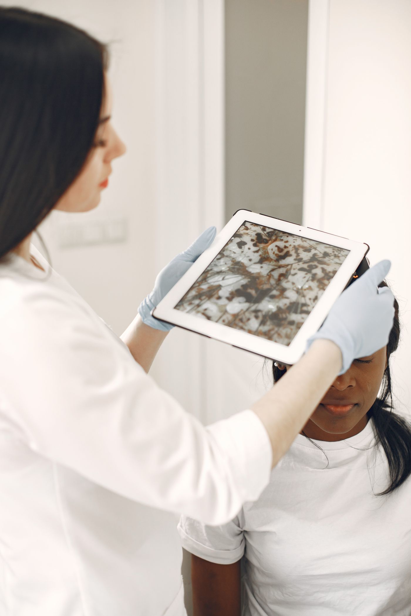Dermatologist examining a patient's skin with a dermatoscope