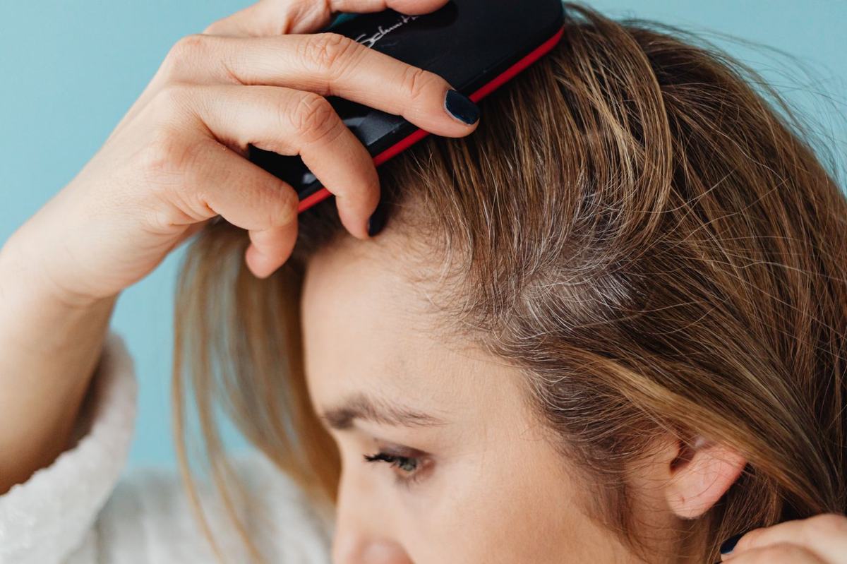 Dermatologist examining a patient's scalp